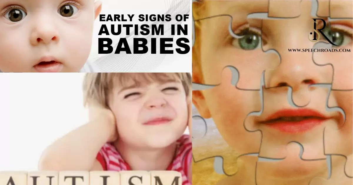 Prominent Signs Your Toddler Is Not Autistic